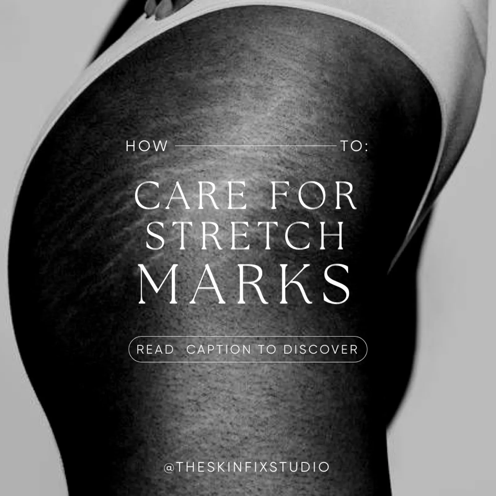 Instagram post by aesthetics_studio